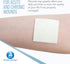 Dynarex DynaGinate Calcium Alginate Wound Dressing - Sterile, Non-Stick Topical Wound Pads - Absorbent Gel Patches for Moderate to High Exuding Cu...