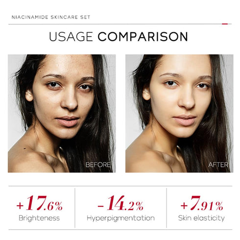 Niacinamide Skincare Set: 4pcs Beauty Kit with Cleanser, Toner, Serum, & Facial Cream - Hydrates & Evens Skin Tone - TSA-Friendly Travel Sizes, Pe...