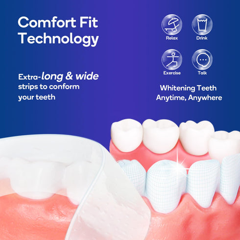 MySmile Advanced Teeth Whitening Strips - Non-Sensitive Formulated 5X Plus Whitening Results, Safe for Enamel - 10 Whitening Strips Dental Stain R...