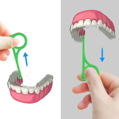 Aligner Removal Tool, 10 Invisible Braces Removal Tools, Retainer Remover Tool, Suitable for Removing Braces, Trays, Retainers, Dentures and Align...