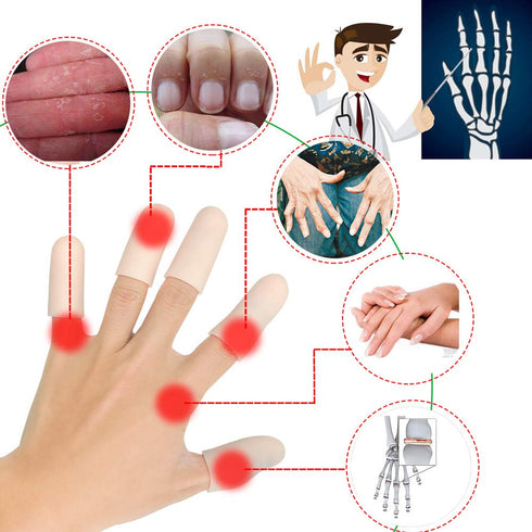 Gel Finger Cots, Finger Protector Support(14 PCS) NEW MATERIAL Finger Sleeves Great for Trigger Finger, Hand Eczema, Finger Cracking, Finger Arthr...