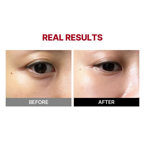 Mega Under Eye Masks (4 Pairs), Wrinkle-Fit Tangle Eye Patch, Korean Eye Mask for Puffiness, Dark Circles, Under Eye Bags, Anti-Wrinkle, Korean Sk...