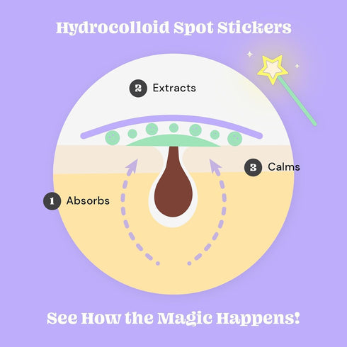 Glossmetics Check Mate Hydrocolloid Spot Stickers - Blemish Dots Clear Pimple Patches for Face, Zit Patches for Blemish Patch (40 Count) (Dots Cle...