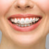 BVN Braces Wax Dental Wax: 20 Boxes Orthodontic Wax Strips, Braces Wax for Teeth, Ortho Wax for Braces, Tooth Wax, Mouth Wax, Oral Wax for Braces,...