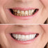 2 Pairs,Men's and Women's Temporary Cosmetic Confident Smile...