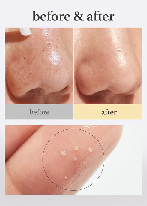 NOONI Korean Facial Oil Cleanser - Snow Aqua 0 LHA Toning Cleansing Oil | Makeup Remover, Pore Control, Essential Step For Double Cleansing, Korea...