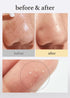 NOONI Korean Facial Oil Cleanser - Snow Aqua 0 LHA Toning Cleansing Oil | Makeup Remover, Pore Control, Essential Step For Double Cleansing, Korea...