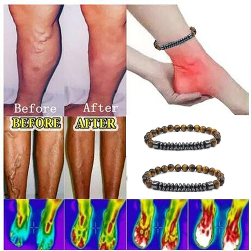 CSIYANJRY99 Lymphatic Drainage Anklet Anti-Swelling Black Obsidian Anklet Therapy Obsidian Bracelet for Women Men...
