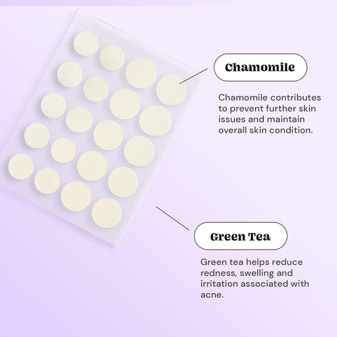 Glossmetics Check Mate Hydrocolloid Spot Stickers - Blemish Dots Clear Pimple Patches for Face, Zit Patches for Blemish Patch (40 Count) (Dots Cle...