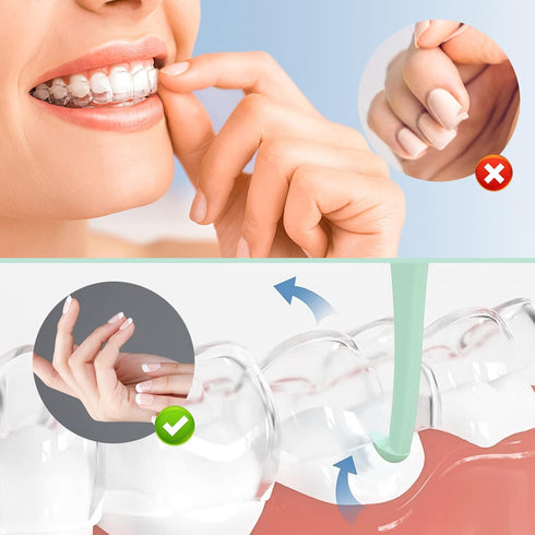 ARGOMAX - Aligner Removal Tool, 5 Invisible Braces Removal Tools, Retainer Remover Tool, Suitable for Removing Braces, Trays, Retainers, Dentures ...