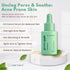 Oil Balance Face Serum for Oily Skin, Vitamin B & Zinc - Tea Tree - Coenzyme Q10 and Nicotinamide, Unclog Pores & Soothe, Acne Prone Skin, Korean ...