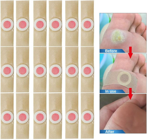 FOMIYES 72 Pcs Corn Remover Pads Callus Cushions Toe Pads Self- Stick Adhesive Foot Care Cushions for Foot Corn Removal Pain Relief Supplies Pink...