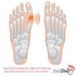 Bunion Corrector Bunion Toe Straightener – Bunion Relief Big Toe Strap Bunion Splint Restores Natural Alignment of Overlapping and Crooked Toes – ...