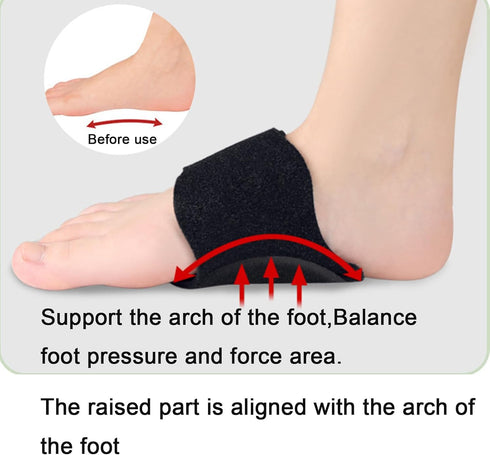 HENGXIA Arch Support Compression Sleeves for Flat Feet, Adjustable Plantar Fasciitis Braces, for Fallen Arches, Orthotic Arch Support Wrap for Hig...