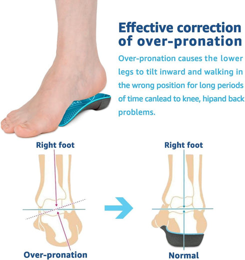 3/4 Orthotic Insoles, Shoe Inserts for Plantar Fasciitis Relief, High Arch Support Inserts for Flat Feet, Over-Pronation and Heel Pain (Small(Men'...