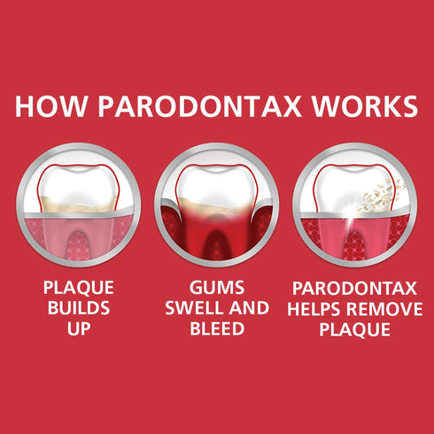 Parodontax Complete Protection Whitening Toothpaste To Help Prevent Bleeding Gums, Anticavity, Gum Toothpaste For Gum Health And Whitening - 3.4 o...
