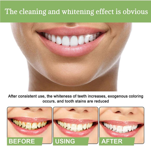 20Pcs Tlopa Ampoule Tooth Serum, Ampoule Essence Toothpaste, Teeth Toothpaste Serum, Solve All Oral Problems....