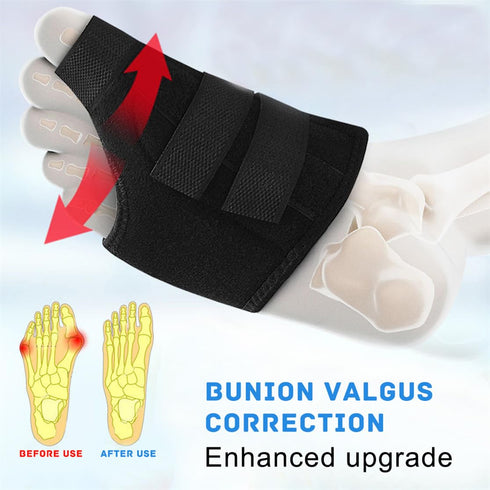 Bunion Corrector Women Men Big Toe, Adjustable Orthopedic Bunion Splint 2 Pcs Bunion Pads for Hallux Valgus Pain Relief Non-Slip Toe Straightener...