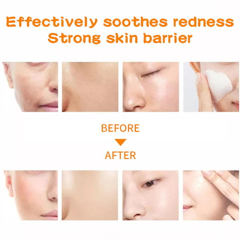 Facial Mask Sheet,Face Mask Skin Care Bulk Pack,Hydrating Spa Face Mask For Sensitive Skin, Facial Masks Sets For Women/Teen Girls (18-Packs)...