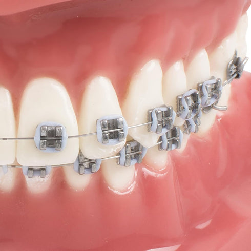 TM-208 Demonstration Orthodontic Model Teeth Teach Study Tools with Metal and Ceramic Bracket(Red)...