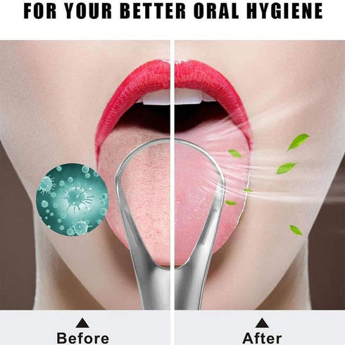 Silvery Tongue Cleaner Brushes Tongue Scraper, Tounge Scrappers Stainless Steel, Portable Tongue Scraper Reduce Bad Breath and Freshing Breath for...