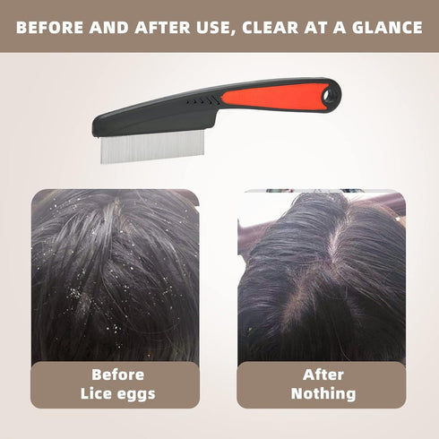 Flea Comb, Dandruff Comb, Multifunction Stainless Steel Fine Tooth Comb Nit Removal Hair Comb Cat Dog Pet Grooming Scalp Flea Comb, Easy to Hold...