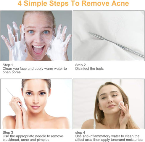 Pimple Popper Tool Kit, UUBAAR 9 PCS Blackhead Remover Tools with Tweezers, 16-Heads Professional Acne Zit Pimple Popper Extraction Tools, Whitehe...