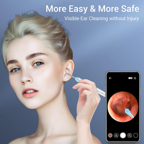 Ear Wax Removal, Ear Cleaner Camera with 1296HD, Ear Wax Removal Kit with 8 Pcs Ear Cleaning Tools, Ear Camera with 6 LED Lights, Ear Cleaner for ...