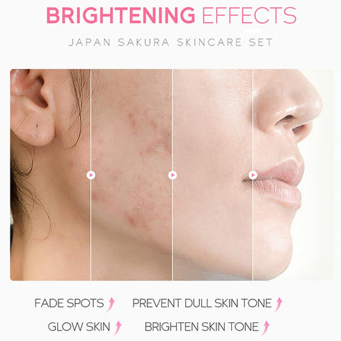 Skin Care Set - Sakura Skin Care Sets & Kits - Women Gift Sets with Cleanser,Serum,Eye Cream,essence Cream - Beauty Products For Women - Skin Care...