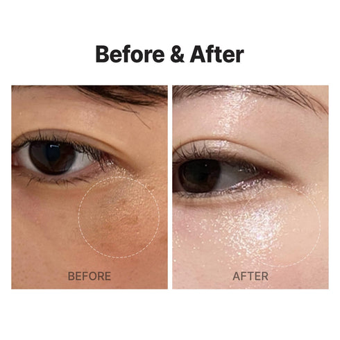 VITA REAL Shot Clear Patch 6EA, Dark Spot Patch, Acne and Blemish Care, Hydrocolloid Patch, Pure Vitamin C for Brightening, Korean Skincare...