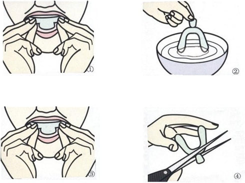 5 Pieces Teeth Whitening Trays Whitening Teeth Trays Whitener Mouth Guard Care Oral Hygiene Bleaching Tooth Tool...