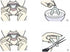 5 Pieces Teeth Whitening Trays Whitening Teeth Trays Whitener Mouth Guard Care Oral Hygiene Bleaching Tooth Tool...