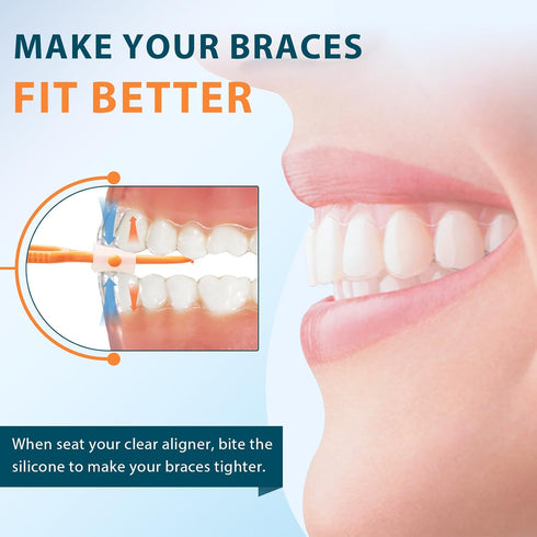 3 pcs 2 IN 1 Clear Aligner Removal & Seating Tool for Invisible Removable Braces & Trays, Retainers - Clean and Hygienic Oral Care Accessory, A Mu...