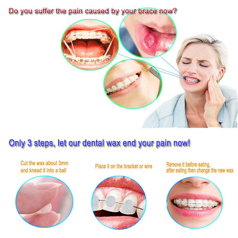 10 Pack Dental Wax Oral Care Orthodontics Wax for Braces Wearer - 10 Color 10 Scent...