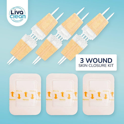 (3 CT) 1 X 3.7” Wound Closure Strips - Zip Stitch Wound Closure Kit - Butterfly Kit Device Zip Tie Skin Closuing Butterfly Bandaids Adhesive Injur...