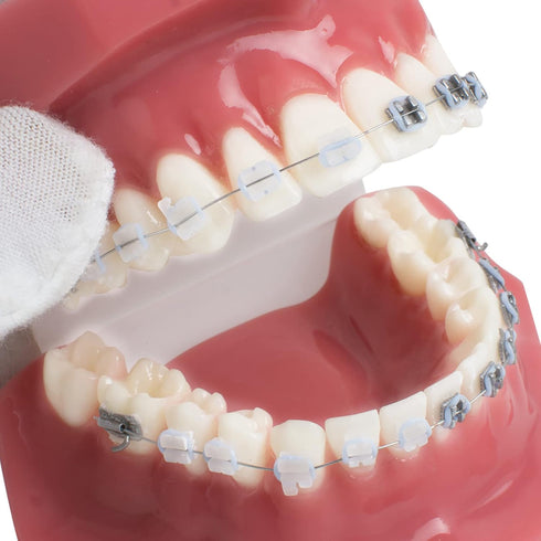 TM-208 Demonstration Orthodontic Model Teeth Teach Study Tools with Metal and Ceramic Bracket(Red)...