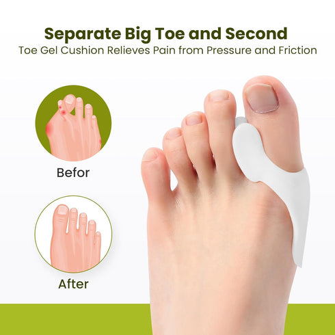 Bukihome Bunion Cushion Protector - 8 Packs Bunion Corrector Pads for Big Toe, Gel Shield for Foot Pain Relief, Calluses, Corns, Friction, and Pre...