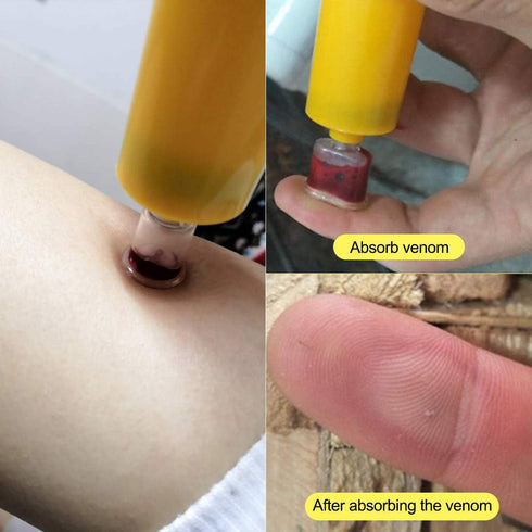 Snake Bite Kit, Bee Sting Kit, Emergency First Aid Supplies, Venom Extractor Suction Pump, Bite and Sting First Aid for Hiking, Backpacking and Ca...