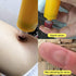 Snake Bite Kit, Bee Sting Kit, Emergency First Aid Supplies, Venom Extractor Suction Pump, Bite and Sting First Aid for Hiking, Backpacking and Ca...