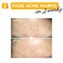 numbuzin No.5+ Vitamin Concentrated Serum | Glutathione & Vitamin Serum, Dark Spot, Korean Skincare 1.01fl.oz/30ml...