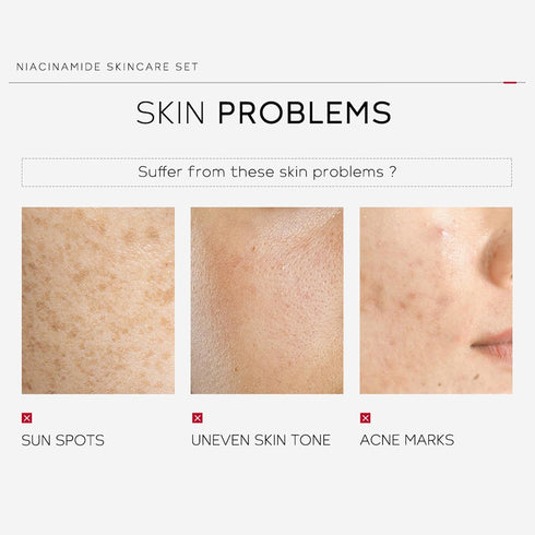 skin care set - skincare set for women - facial skin care sets & kits - gift set skincare - skin care sets for teens- skin care sets for men (cera...