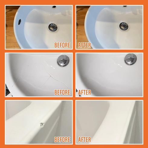 Porcelain Repair Kit White, Sink & Tile Repair Kit to Quickly Fix Sinks Chips and Tile Cracks with High Bond Strength, Porcelain Sink Repair Kit f...