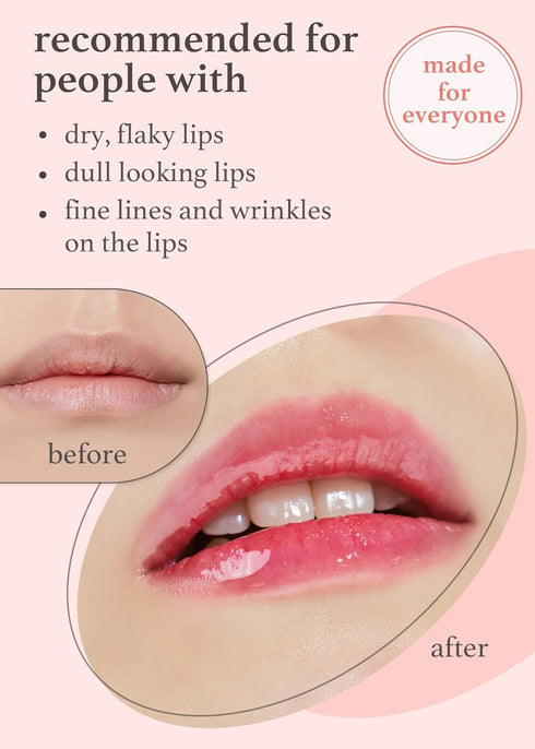 NOONI Korean Lip Oil - Applepeony | Lip Stain, Gift, Long-Lasting, Moisturizing, Plumping, Revitalizing for Dry Lips, Waterproof, No Peel Off, Kor...