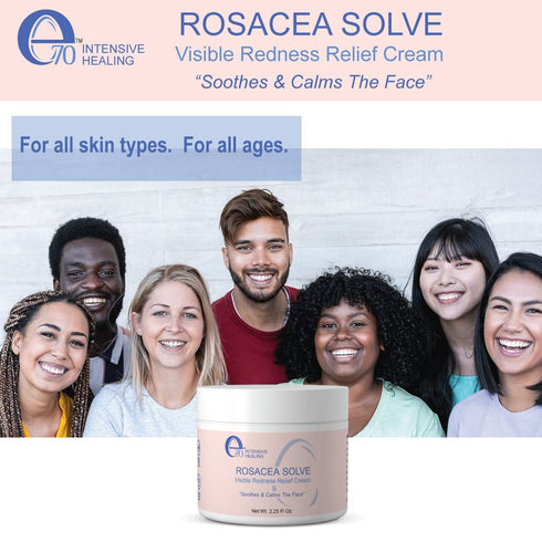 Rosacea Solve - Redness Relief Cream - Face Moisturizer For Rosacea & Acne Prone Skin - Sensitive Skin Care With Organic Ingredients, Almond Oil, ...