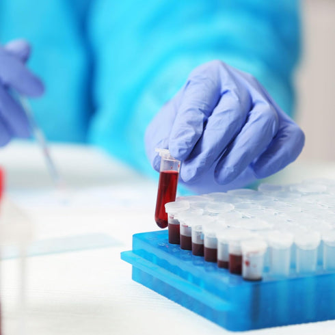 PATIKIL 25 Well Centrifuge Tube Freezer Storage Box, 2 Pcs Polypropylene Tube Rack for 1.8ML and 2.0ML Tubes Vials Samples, Red...