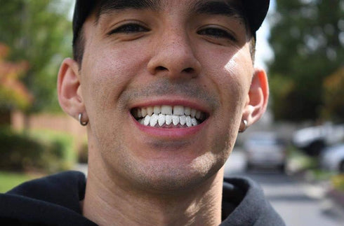 TOPGRILLZ 18K Gold Plated Iced Out Simulated 8 Top and Bottom Diamond Grills for Your Teeth with Extra Molding Bars...