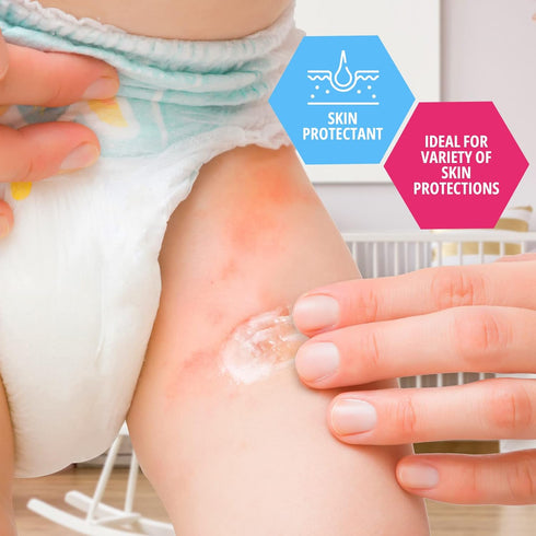 MED PRIDE Petroleum Jelly With Fresh Baby Scent - Skin Protectant For Dry Skin, Rashes, Minor Burns & Wounds- Powerful Moisturizer For Chapped Lip...