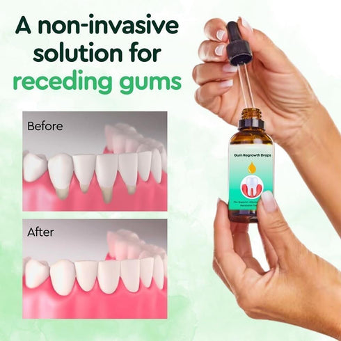 Gum Relief Drops, DentiZen Gum Regrowth Drops, Gum Treatment for Receding Gums, Oil Pulling for Teeth and Gums (2Pcs)...