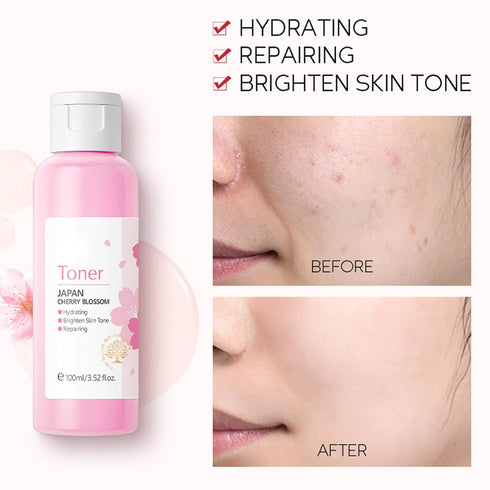 Sakura Face Care Set for Women, 17Pcs Moisturizing Skin Care Set Include Sakura Cream, Cleanser, Serum, Toner, Eye Cream, Lip Mask, Mud Mask, Slee...