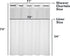 River Dream Plastic(PEVA) Snap in Shower Curtain Liner Replacement with Magnets Removable Liner (1, Plastic-Update)...